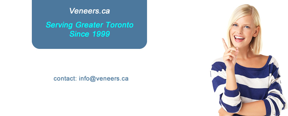 veneers Mississauga, Toronto, Brampton, Oakville, Etobicoke